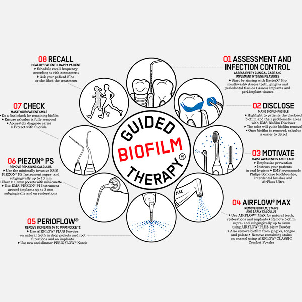 Guided-Biofilm-Therapy-Ablauf
